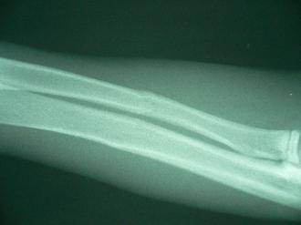 摜(330x247)Eg摜(640x480)