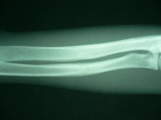 摜(330x247)Eg摜(640x480)